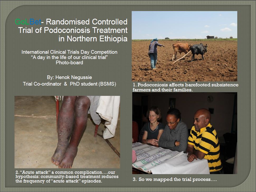 golbet, ethiopia, podoconiosis, global health trial